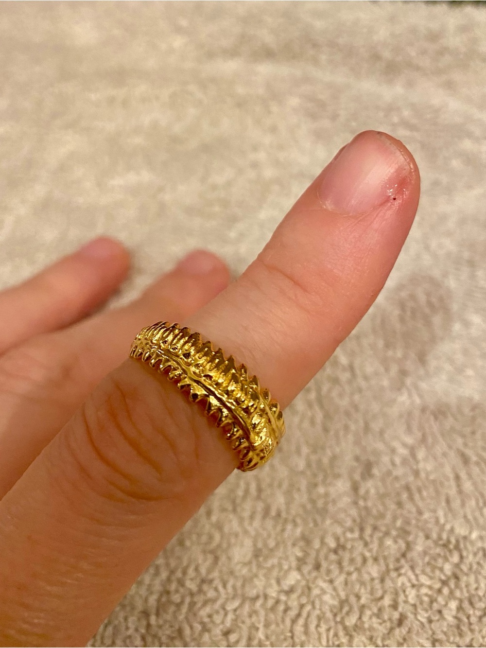 Verameat spine ring- adjustable size